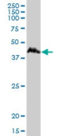 Anti-CCNDBP1 antibody produced in mouse