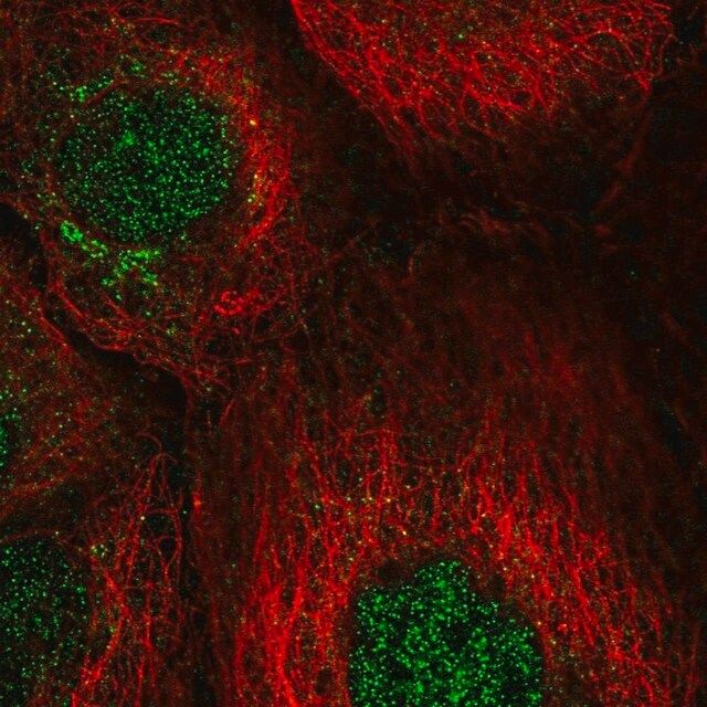 Anti-CCNJ antibody produced in rabbit