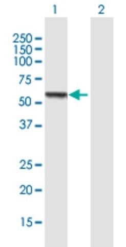 Anti-CCM2 antibody produced in mouse