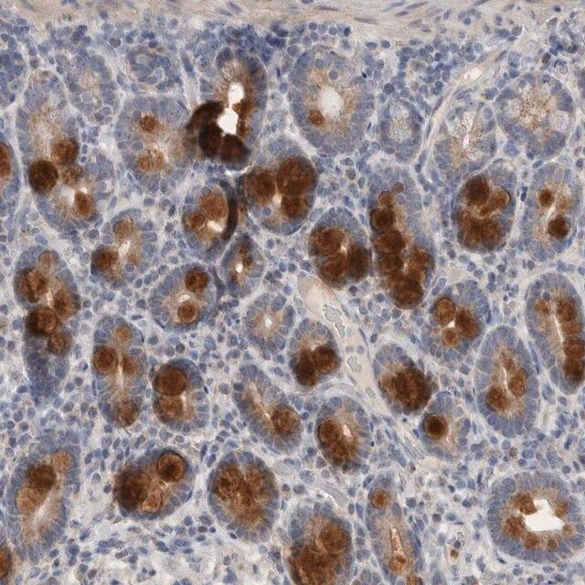 Anti-CCDC126 antibody produced in rabbit