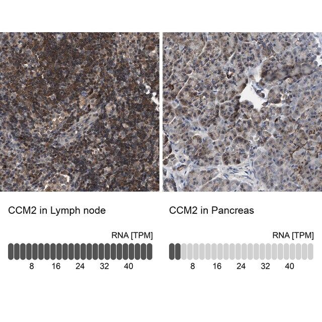 Anti-CCM2 antibody produced in rabbit