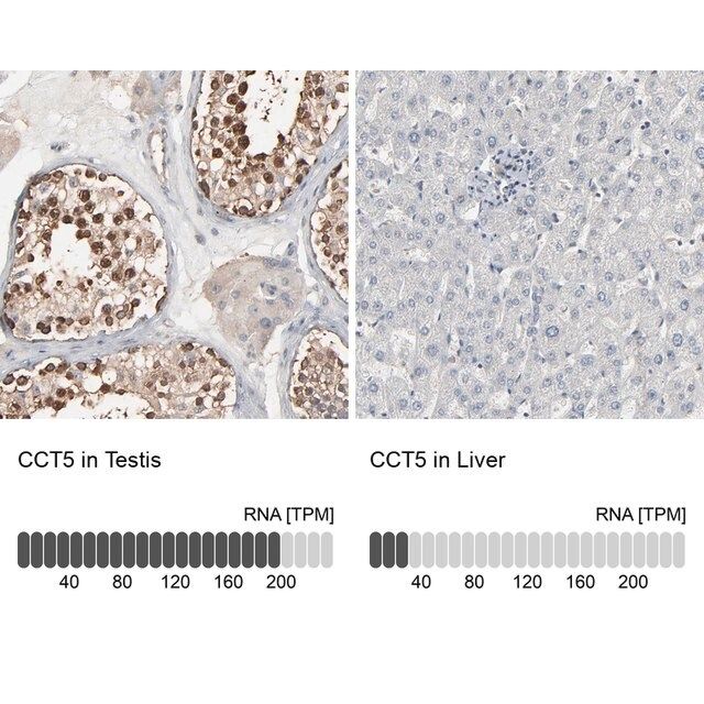 Anti-CCT5 antibody produced in rabbit