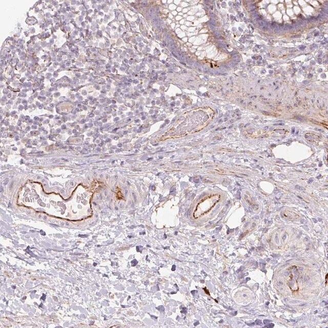 Anti-CCNI2 antibody produced in rabbit