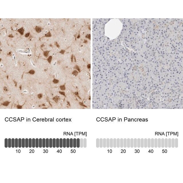 Anti-CCSAP antibody produced in rabbit