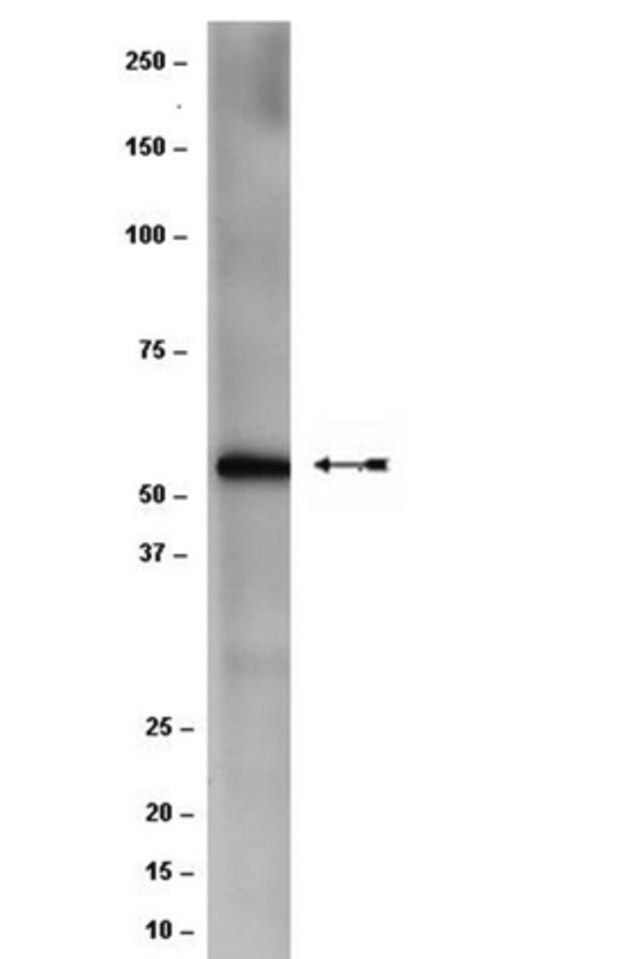 Anti-CCT-beta Antibody, clone F39 P7 F11