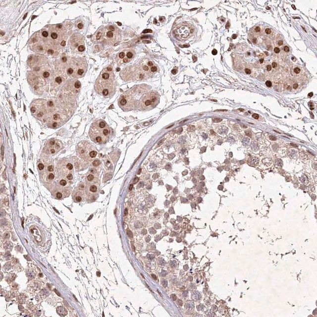 Anti-CCSER2 antibody produced in rabbit