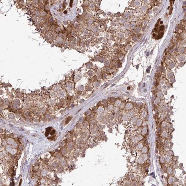 Anti-CCS antibody produced in rabbit