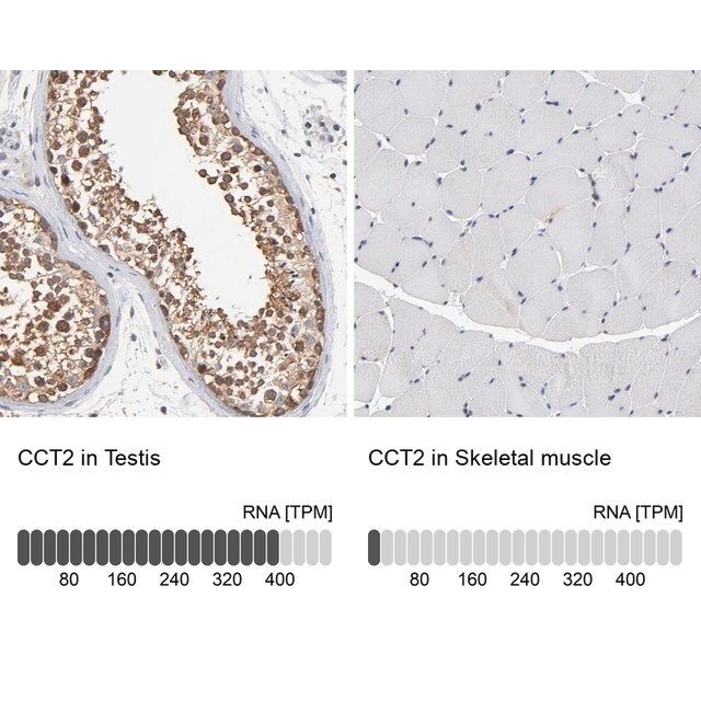 Anti-CCT2 antibody produced in rabbit