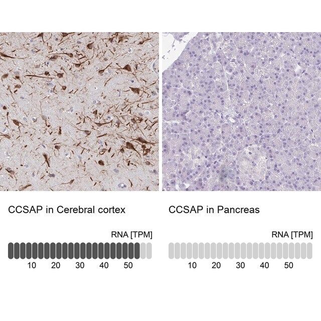 Anti-CCSAP antibody produced in rabbit