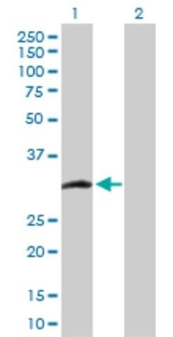 Anti-CCS antibody produced in rabbit