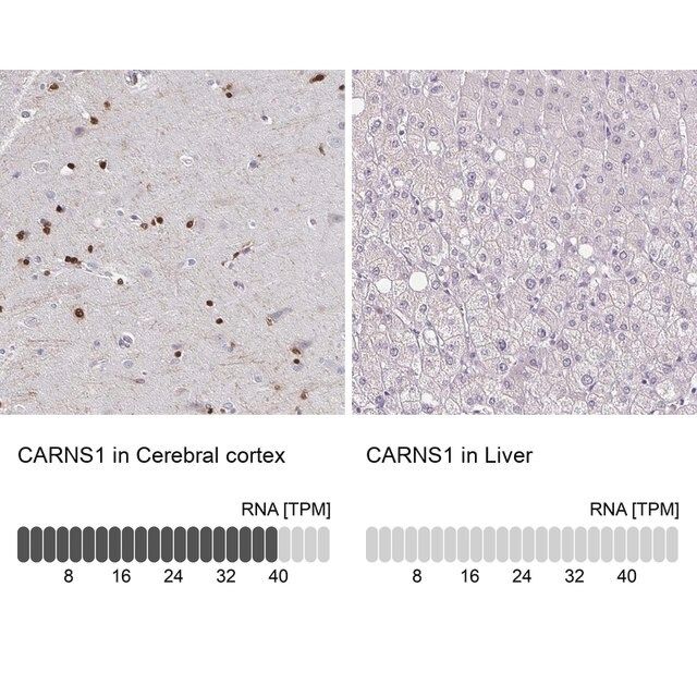 Anti-CARNS1 antibody produced in rabbit