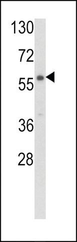 ANTI-CARS2(C-TERMINAL) antibody produced in rabbit