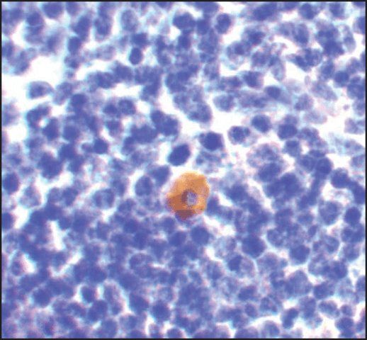 Anti-CARMA1 antibody produced in rabbit