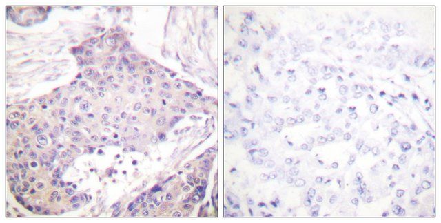 Anti-CARD6 antibody produced in rabbit