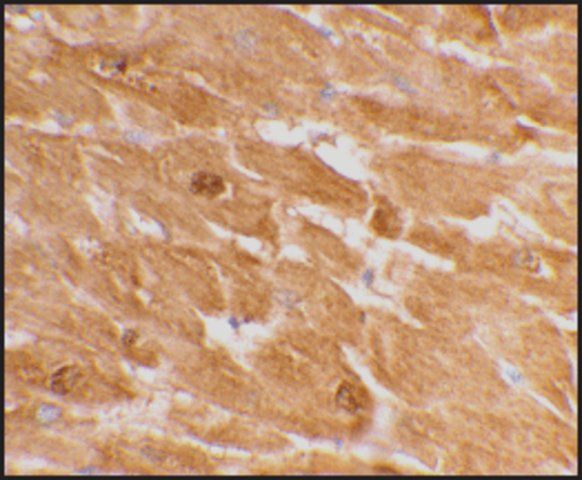 Anti-Caspase-12 (large) antibody produced in rabbit