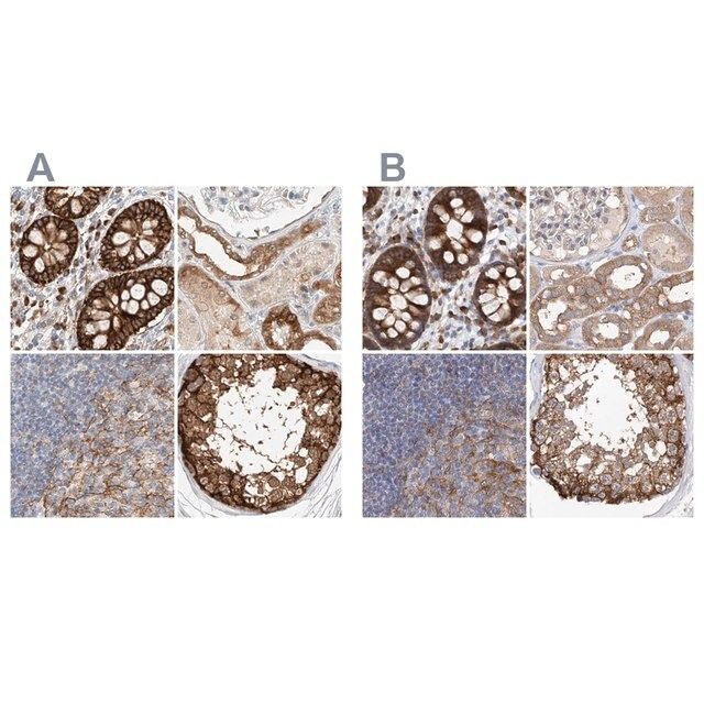 Anti-CARMIL1 antibody produced in rabbit