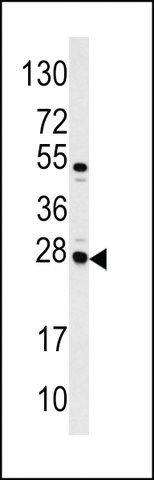 ANTI-CASA (CENTER) antibody produced in rabbit