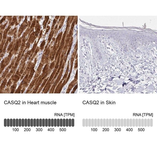 Anti-CASQ2 antibody produced in rabbit