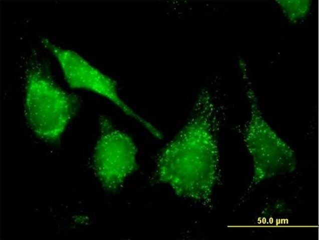 Anti-CAT antibody produced in mouse