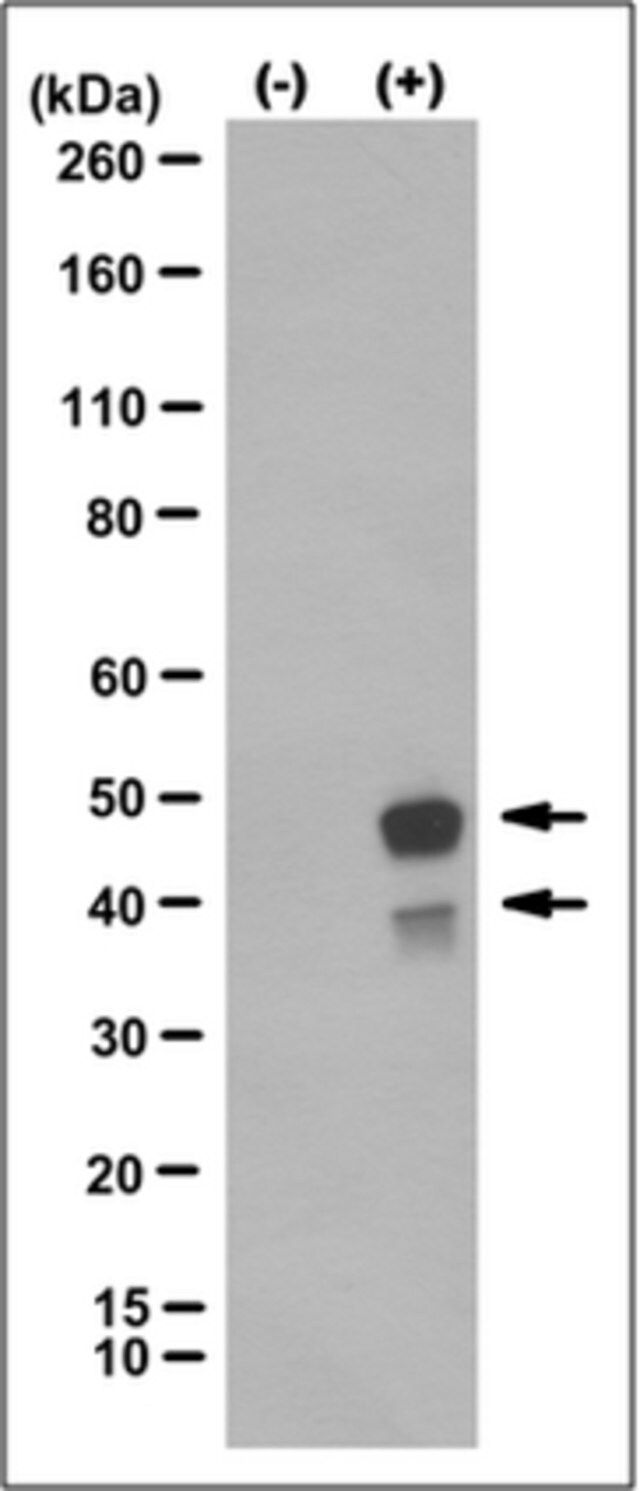 Anti-Caspase-4, clone 17D9 Antibody