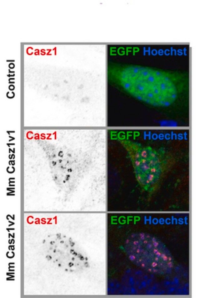 Anti-CASZ1 Antibody