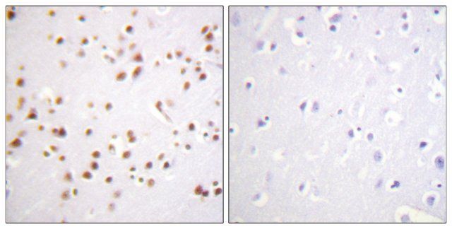 Anti-Catenin-1 antibody produced in rabbit