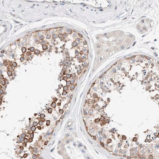 Anti-CASC3 antibody produced in rabbit