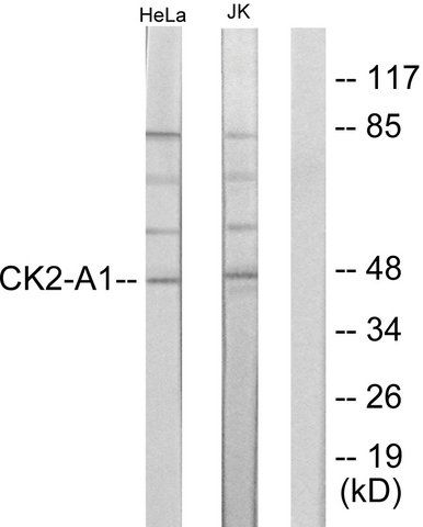 Anti-Casein Kinase II  antibody produced in rabbit