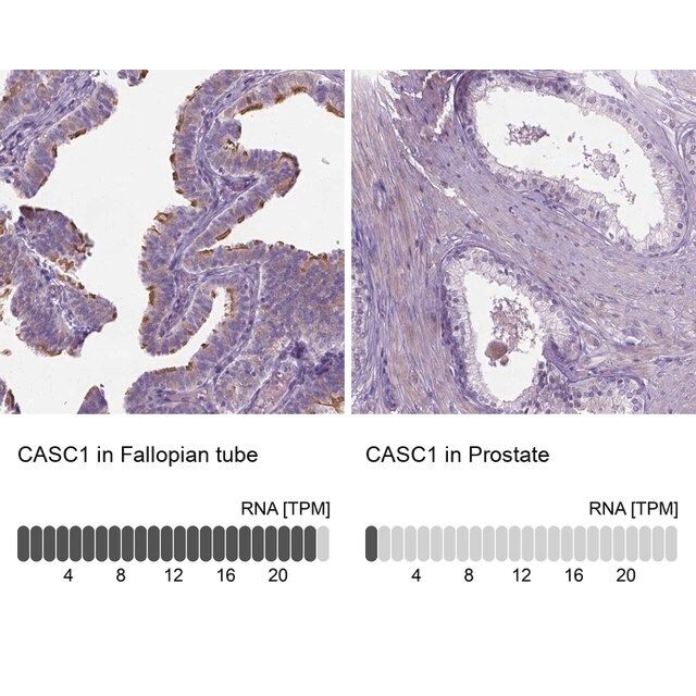 Anti-CASC1 antibody produced in rabbit