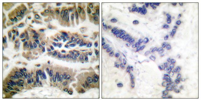 Anti-CASP6 antibody produced in rabbit