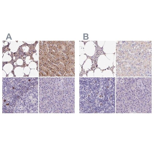 Anti-CAT antibody produced in rabbit