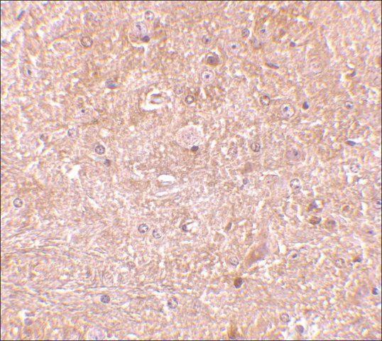 Anti-Caspase-13 antibody produced in rabbit