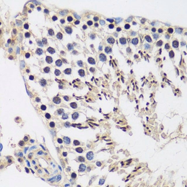 Anti-CASC5 antibody produced in rabbit