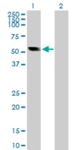 Anti-CASQ2 antibody produced in rabbit