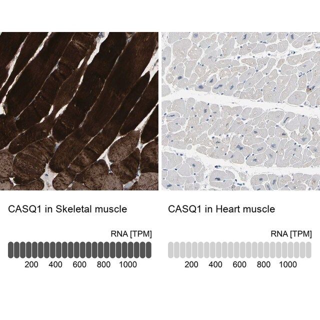 Anti-CASQ1 antibody produced in rabbit