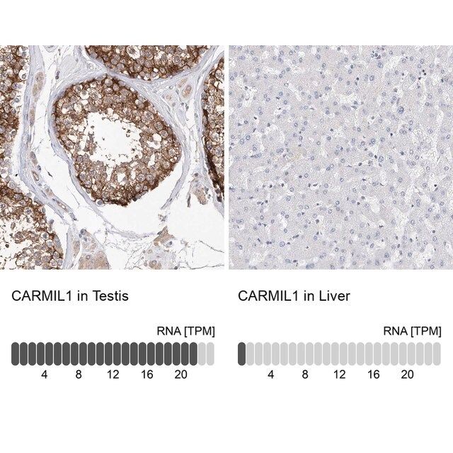 Anti-CARMIL1 antibody produced in rabbit