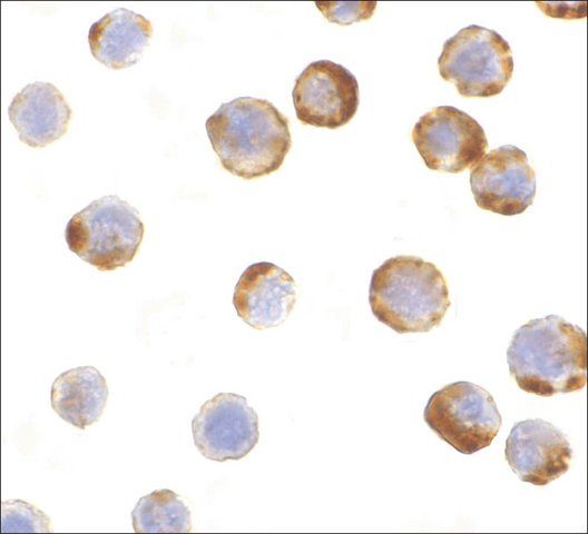 Anti-Caspase-6 antibody produced in rabbit