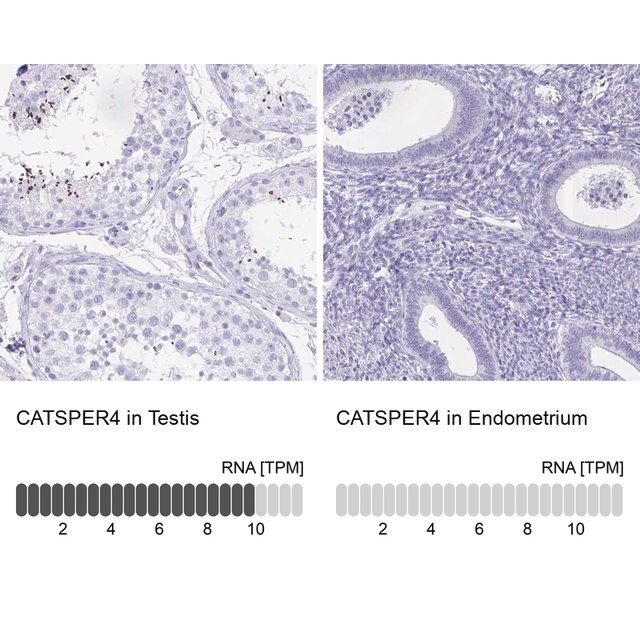 Anti-CATSPER4 antibody produced in rabbit