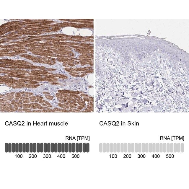 Anti-CASQ2 antibody produced in rabbit