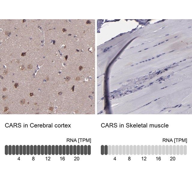 Anti-CARS antibody produced in rabbit