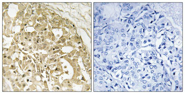 Anti-Catenin- antibody produced in rabbit