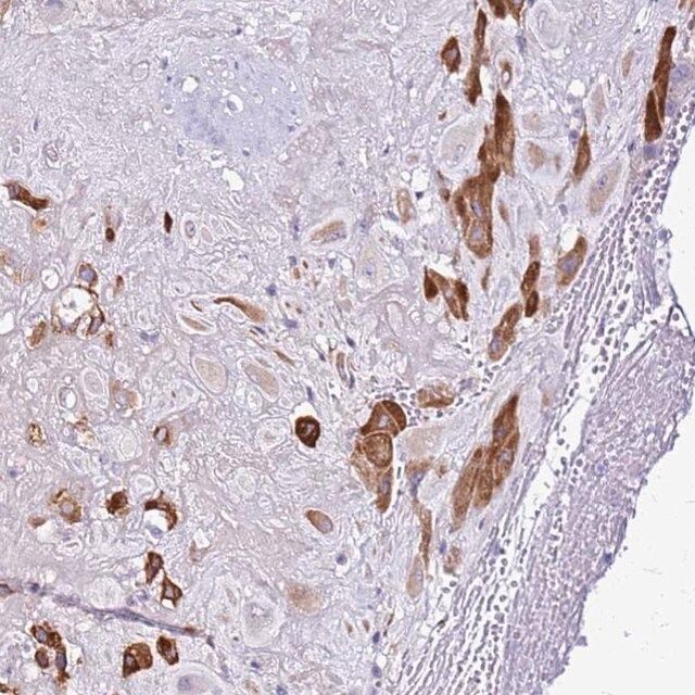 Anti-CASD1 antibody produced in rabbit