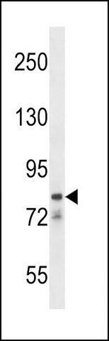 ANTI-CATSPER1 (N-TERM) antibody produced in rabbit