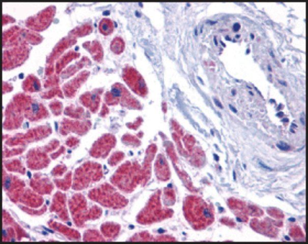 Anti-CASPASE-12 (ab1) antibody produced in rabbit