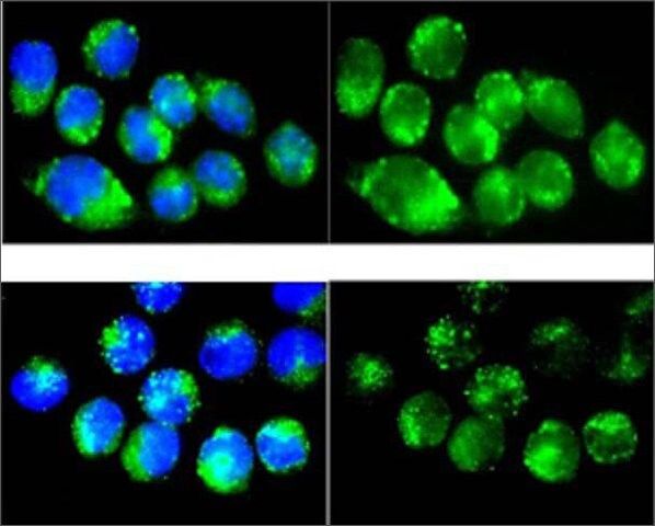 Anti-CAT antibody produced in rabbit