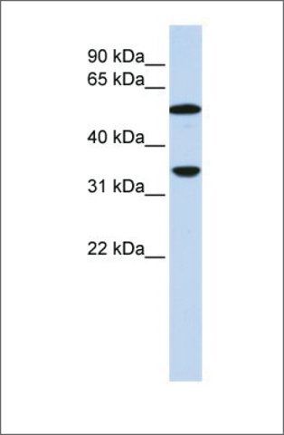 Anti-C4B antibody produced in rabbit