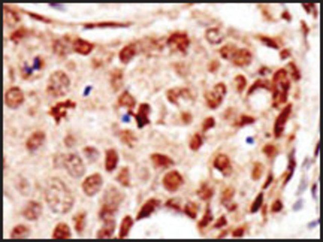 Anti-Cbl (C-term) antibody produced in rabbit