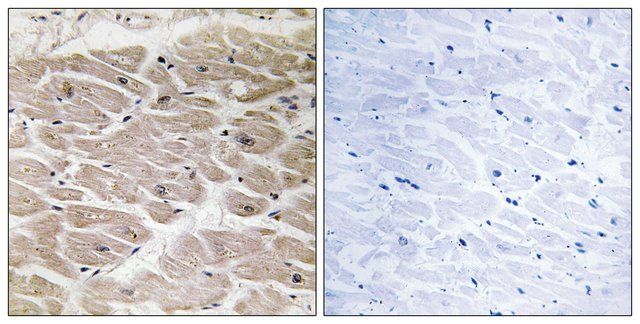 Anti-CBCP2, C-Terminal antibody produced in rabbit