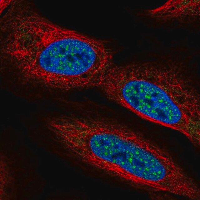 Anti-CBFA2T2 antibody produced in rabbit