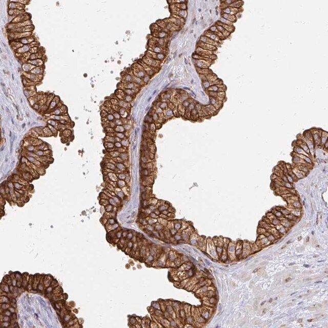 Anti-CAST antibody produced in rabbit